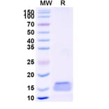 SDS-PAGE - Anti-TLR4 Nanobody [SAA1263] (A337714) - Antibodies.com