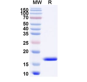 SDS-PAGE - Anti-CXCL11 Nanobody [SAA1272] (A337715) - Antibodies.com