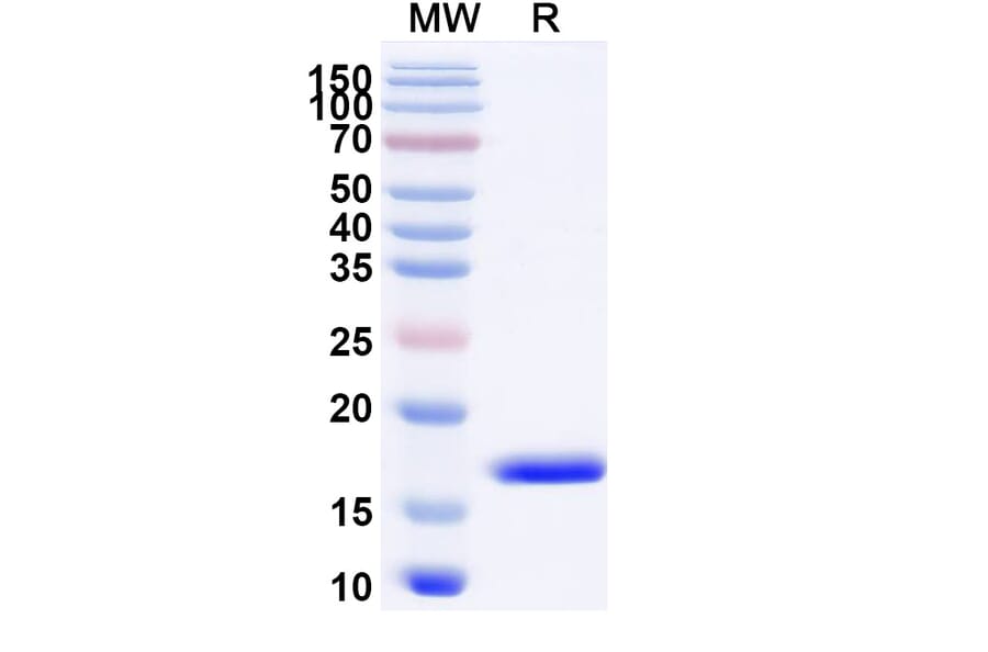 SDS-PAGE - Anti-CXCL11 Nanobody [SAA1272] (A337715) - Antibodies.com