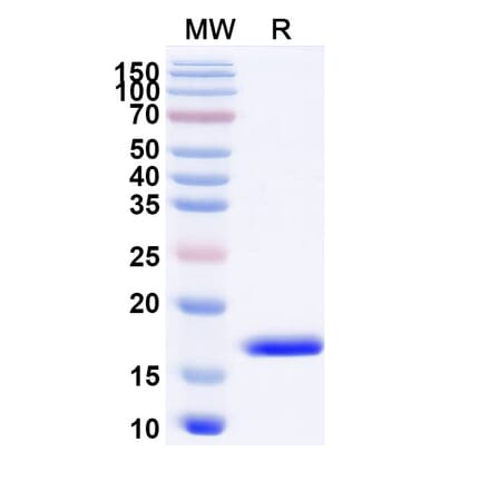 SDS-PAGE - Anti-CXCL11 Nanobody [SAA1272] (A337715) - Antibodies.com
