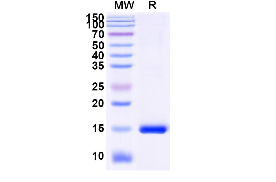 SDS-PAGE - Anti-ADAM10 Nanobody [SAA1217] (A337716) - Antibodies.com