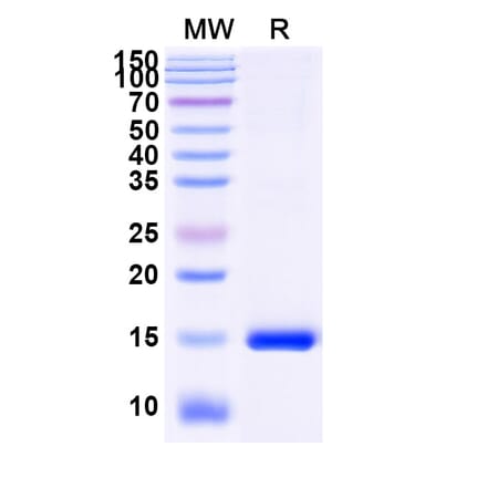 SDS-PAGE - Anti-ADAM10 Nanobody [SAA1217] (A337716) - Antibodies.com