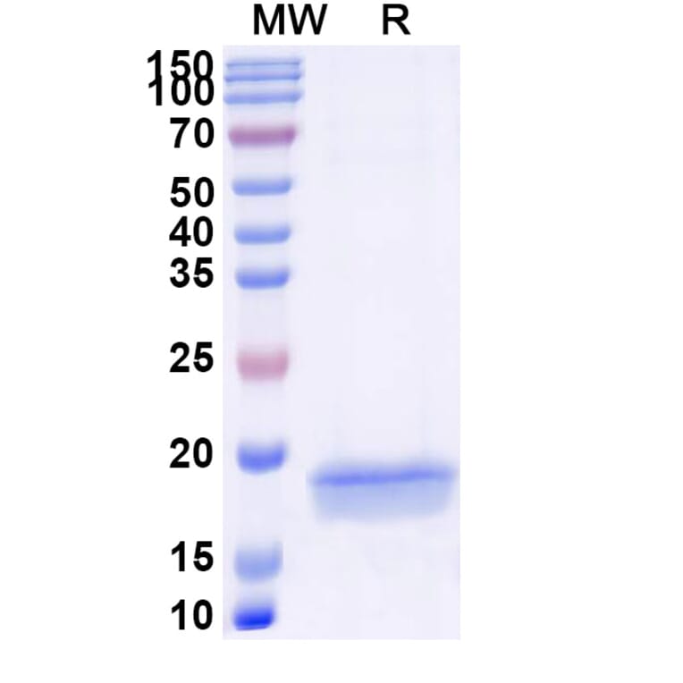 SDS-PAGE - Anti-Aurora A Nanobody [SAA1200] (A337717) - Antibodies.com