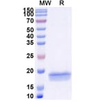 SDS-PAGE - Anti-Aurora A Nanobody [SAA1200] (A337717) - Antibodies.com