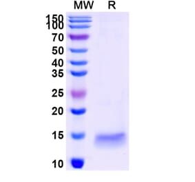 SDS-PAGE - Anti-GAK Nanobody [SAA1190] (A337718) - Antibodies.com