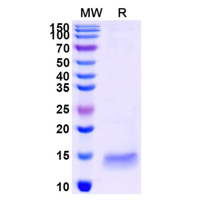 SDS-PAGE - Anti-GAK Nanobody [SAA1190] (A337718) - Antibodies.com