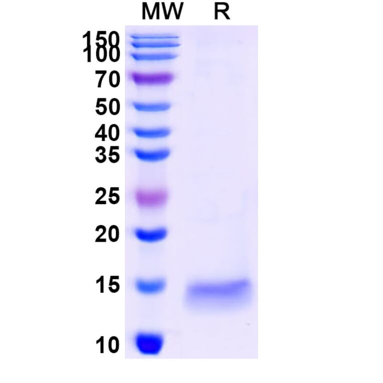 SDS-PAGE - Anti-GAK Nanobody [SAA1190] (A337718) - Antibodies.com