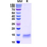 SDS-PAGE - Anti-GAK Nanobody [SAA1190] (A337718) - Antibodies.com
