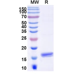 SDS-PAGE - Anti-Angiopoietin 2 Nanobody [SAA1255] (A337719) - Antibodies.com