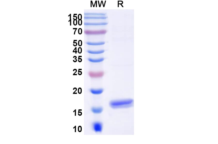 SDS-PAGE - Anti-Angiopoietin 2 Nanobody [SAA1255] (A337719) - Antibodies.com