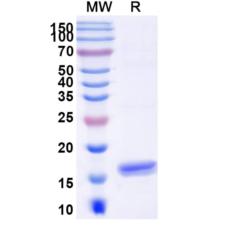 SDS-PAGE - Anti-Angiopoietin 2 Nanobody [SAA1255] (A337719) - Antibodies.com
