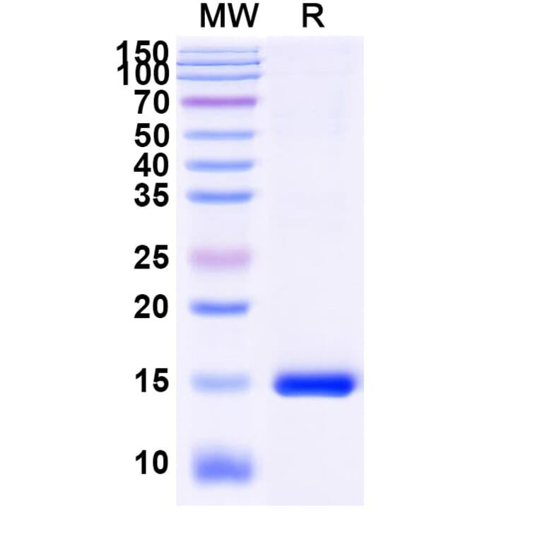 SDS-PAGE - Anti-MDMX Nanobody [SAA1189] (A337720) - Antibodies.com