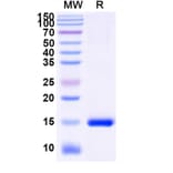 SDS-PAGE - Anti-MDMX Nanobody [SAA1189] (A337720) - Antibodies.com