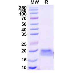 SDS-PAGE - Anti-EphB6 Nanobody [SAA1264] (A337721) - Antibodies.com