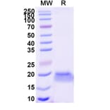 SDS-PAGE - Anti-EphB6 Nanobody [SAA1264] (A337721) - Antibodies.com