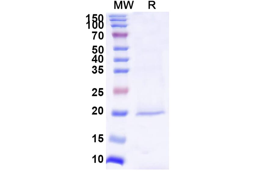 SDS-PAGE - Anti-Survivin Nanobody [SAA1237] (A337723) - Antibodies.com