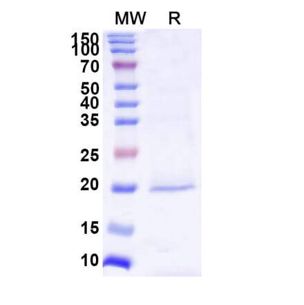 SDS-PAGE - Anti-Survivin Nanobody [SAA1237] (A337723) - Antibodies.com