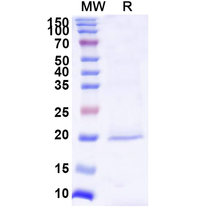 SDS-PAGE - Anti-Survivin Nanobody [SAA1237] (A337723) - Antibodies.com