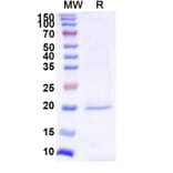 SDS-PAGE - Anti-Survivin Nanobody [SAA1237] (A337723) - Antibodies.com