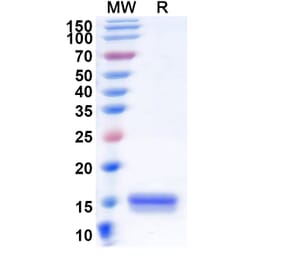 SDS-PAGE - Anti-Synaptojanin 1 Nanobody [SAA1056] (A337724) - Antibodies.com