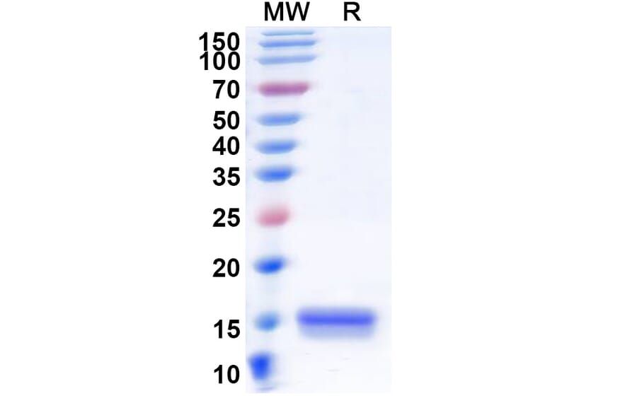 SDS-PAGE - Anti-Synaptojanin 1 Nanobody [SAA1056] (A337724) - Antibodies.com