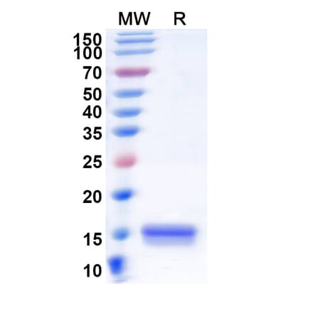 SDS-PAGE - Anti-Synaptojanin 1 Nanobody [SAA1056] (A337724) - Antibodies.com