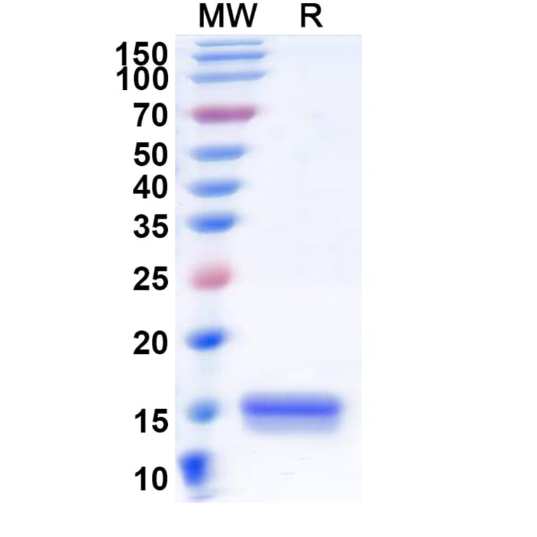 SDS-PAGE - Anti-Synaptojanin 1 Nanobody [SAA1056] (A337724) - Antibodies.com