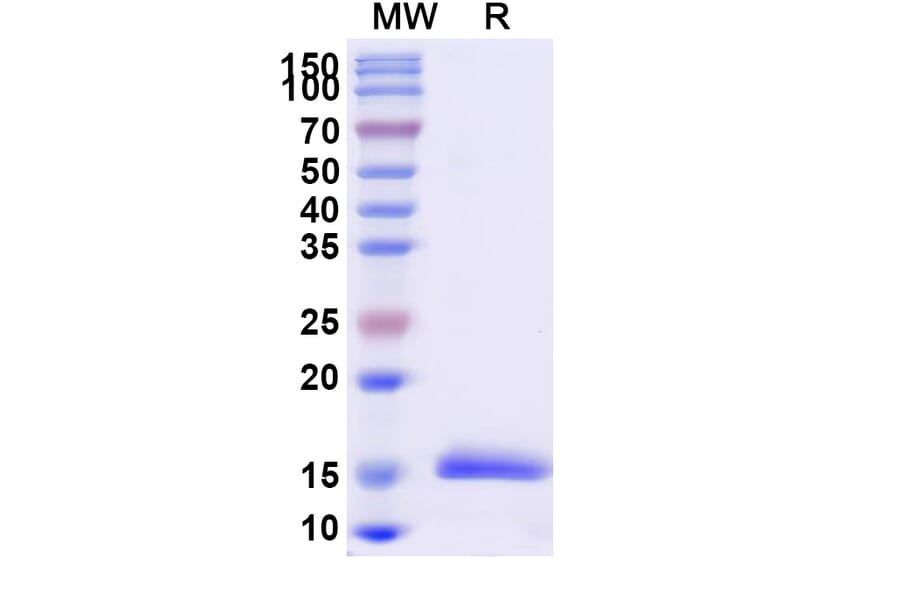 SDS-PAGE - Anti-Synaptojanin 1 Nanobody [SAA1055] (A337725) - Antibodies.com