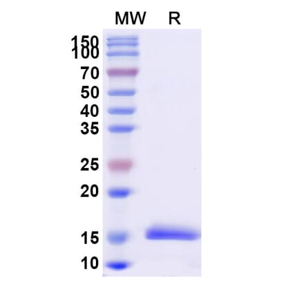SDS-PAGE - Anti-Synaptojanin 1 Nanobody [SAA1055] (A337725) - Antibodies.com