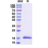 SDS-PAGE - Anti-Synaptojanin 1 Nanobody [SAA1055] (A337725) - Antibodies.com