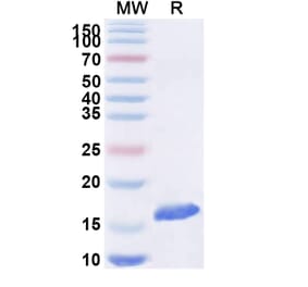 SDS-PAGE - Anti-Doublecortin Nanobody [SAA1176] (A337726) - Antibodies.com