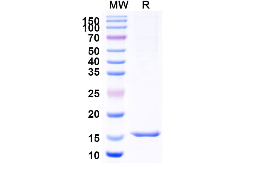 SDS-PAGE - Anti-Doublecortin Nanobody [SAA1021] (A337727) - Antibodies.com