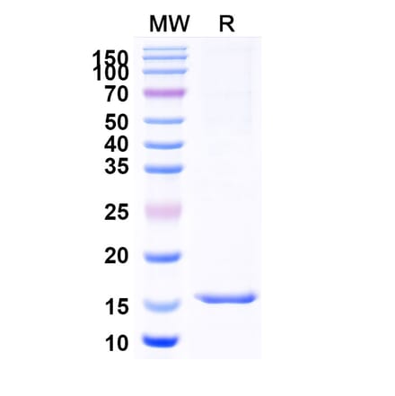 SDS-PAGE - Anti-Doublecortin Nanobody [SAA1021] (A337727) - Antibodies.com