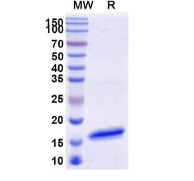 SDS-PAGE - Anti-CD16b Nanobody [SAA1310] (A337728) - Antibodies.com