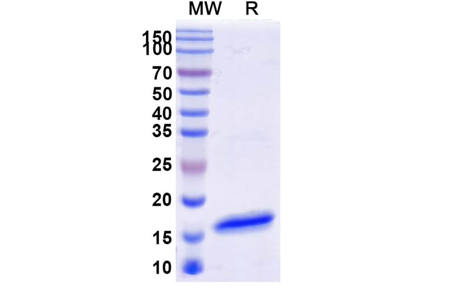 SDS-PAGE - Anti-CD16b Nanobody [SAA1310] (A337728) - Antibodies.com