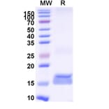 SDS-PAGE - Anti-B7-H2 Nanobody [SAA1282] (A337729) - Antibodies.com