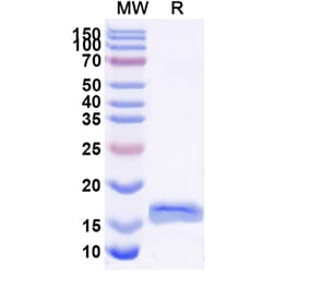 SDS-PAGE - Anti-PSIP1 Nanobody [SAA1182] (A337730) - Antibodies.com