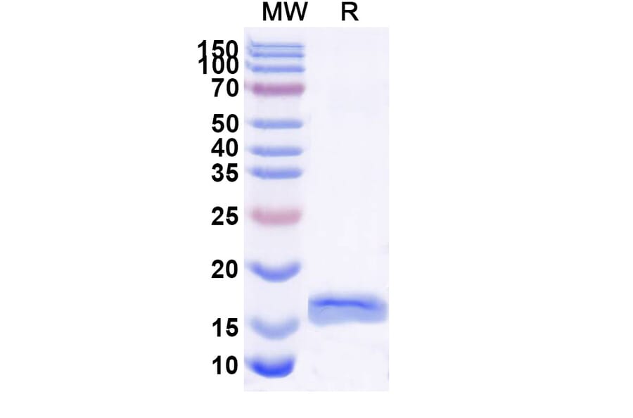 SDS-PAGE - Anti-PSIP1 Nanobody [SAA1182] (A337730) - Antibodies.com