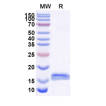 SDS-PAGE - Anti-PSIP1 Nanobody [SAA1182] (A337730) - Antibodies.com