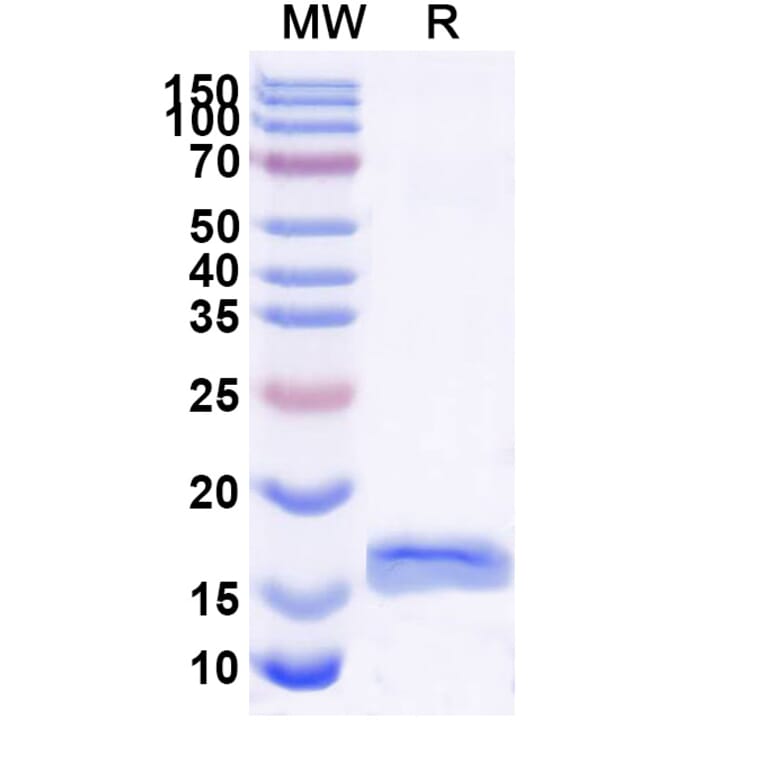 SDS-PAGE - Anti-PSIP1 Nanobody [SAA1182] (A337730) - Antibodies.com