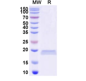 SDS-PAGE - Anti-LRP6 Nanobody [SAA0903] (A337732) - Antibodies.com