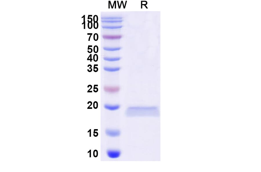 SDS-PAGE - Anti-LRP6 Nanobody [SAA0903] (A337732) - Antibodies.com