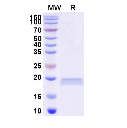 SDS-PAGE - Anti-LRP6 Nanobody [SAA0903] (A337732) - Antibodies.com