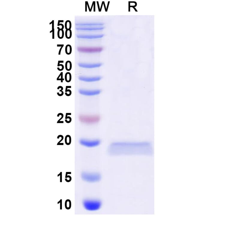 SDS-PAGE - Anti-LRP6 Nanobody [SAA0903] (A337732) - Antibodies.com