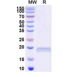 SDS-PAGE - Anti-LRP6 Nanobody [SAA0903] (A337732) - Antibodies.com