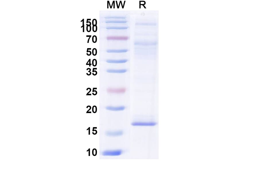 SDS-PAGE - Anti-RECQL5 Nanobody [SAA1003] (A337734) - Antibodies.com