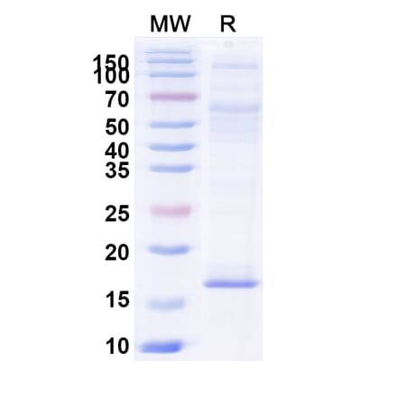 SDS-PAGE - Anti-RECQL5 Nanobody [SAA1003] (A337734) - Antibodies.com