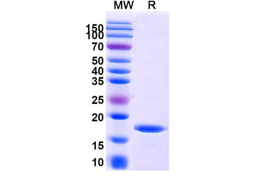 SDS-PAGE - Anti-RECQL5 Nanobody [SAA1014] (A337735) - Antibodies.com