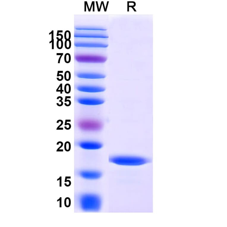 SDS-PAGE - Anti-RECQL5 Nanobody [SAA1014] (A337735) - Antibodies.com