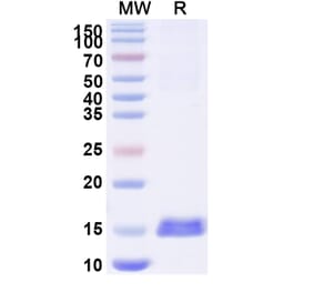 SDS-PAGE - Anti-RECQL5 Nanobody [SAA1129] (A337736) - Antibodies.com